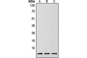 Western blot analysis of Caspase 14 p10 expression in MCF7 (A), mouse spleen (B), rat liver (C) whole cell lysates. (Caspase 14 p10 antibody  (Center))