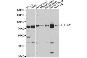 Western blot analysis of extracts of various cell lines, using TGFBR2 antibody. (TGFBR2 antibody)