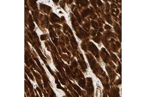 Immunohistochemical staining of human heart muscle with HRC polyclonal antibody  shows strong cytoplasmic positivity in myocytes.