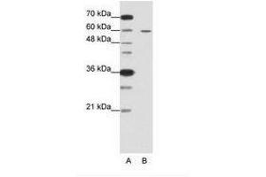 Image no. 2 for anti-Frizzled Family Receptor 5 (FZD5) (C-Term) antibody (ABIN6736225)