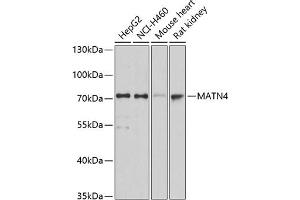 Western blot analysis of extracts of various cell lines, using M antibody (ABIN3016623, ABIN3016624, ABIN1680779 and ABIN6219802) at 1:3000 dilution.