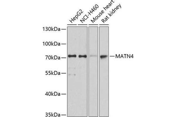 MATN4 antibody  (AA 221-540)
