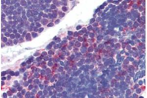 Thymus, Human: Formalin-Fixed, Paraffin-Embedded (FFPE) (AKT1/2 antibody)