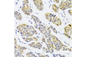 Immunohistochemistry (Paraffin-embedded Sections) (IHC (p)) image for anti-Replication Factor C (Activator 1) 4, 37kDa (RFC4) (AA 204-363) antibody (ABIN6146881)