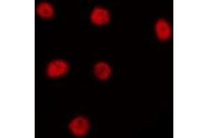 ABIN6274984 staining HepG2 by IF/ICC. (LYAR antibody  (Internal Region))