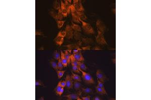 Immunofluorescence analysis of C6 cells using MEK1 antibody (ABIN7268633). (MEK1 antibody)