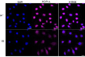 Immunocytochemical staining of HeLa cells using PCYT1A antibody (ABIN7799789), 1:1,000), Top panel: wild-type (WT), Bottom panal: PCYT1A shRNA knockdown (KD). (Recombinant PCYT1A antibody)