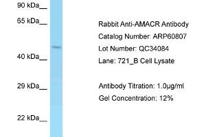Western Blotting (WB) image for anti-alpha-Methylacyl-CoA Racemase (AMACR) (Middle Region) antibody (ABIN2788590) (AMACR antibody  (Middle Region))