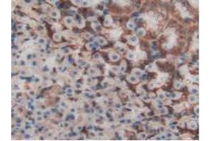 Immunohistochemistry (IHC) image for anti-S100 Calcium Binding Protein A11 (S100A11) (AA 9-98) antibody (ABIN7432082)