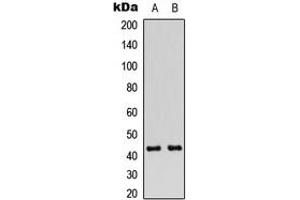 Western blot analysis of Connexin 43 (pS368) expression in Jurkat (A), A549 (B) whole cell lysates. (Connexin 43/GJA1 antibody  (C-Term, pSer368))