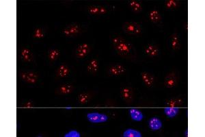 Confocal immunofluorescence analysis of U2OS cells using MYBBP1A Polyclonal Antibody at dilution of 1:200. (MYBBP1A antibody)