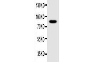 Anti-NLRP4G antibody, Western blotting WB: Mouse Ovary Tissue Lysate (NLRP4G antibody  (C-Term))