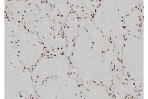 ABIN6269358 at 1/100 staining Human lung tissue by IHC-P. (IRF3 antibody  (C-Term))