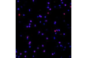 Immunofluorescence (Paraffin-embedded Sections) (IF (p)) image for anti-Mediator Complex Subunit 8 (MED8) antibody (ABIN7074582)