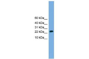 WB Suggested Anti-CSH2 Antibody Titration: 0. (CSH1 antibody  (Middle Region))