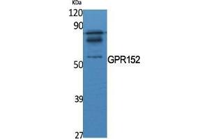 Western Blot (WB) analysis of specific cells using GPR152 Polyclonal Antibody.