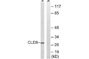 Western blot analysis of extracts from Jurkat cells, using CLDN8 antibody. (CLDN8 antibody)