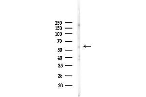 anti-Zinc Finger Protein 238 (ZNF238) (Internal Region) antibody