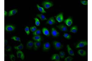 Immunofluorescence staining of A549 cells with ABIN7153831 at 1:66, counter-stained with DAPI. (GSG1-Like antibody  (AA 84-176))