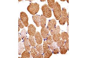 Immunohistochemical analysis of paraffin-embedded H. (SIRPB1 antibody  (N-Term))