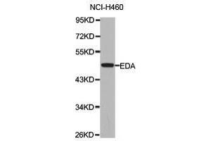 Western Blotting (WB) image for anti-Ectodysplasin A (EDA) antibody (ABIN1872415) (Ectodysplasin A antibody)