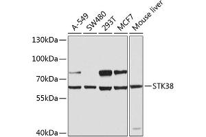 Western blot analysis of extracts of various cell lines, using STK38 antibody (ABIN6132692, ABIN6148616, ABIN6148617 and ABIN6224215) at 1:1000 dilution. (STK38 antibody  (AA 1-200))