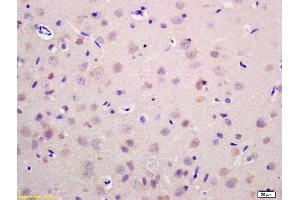 Formalin-fixed and paraffin embedded rat brain labeled with Anti-RAB21 Polyclonal Antibody, Unconjugated (ABIN758516) at 1:200 followed by conjugation to the secondary antibody and DAB staining. (RAB21 antibody  (AA 51-150))