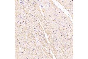 Immunohistochemistry analysis of paraffin-embedded rat heart using,Myoz2 (ABIN7074744) at dilution of 1: 6000 (MYOZ2 antibody)