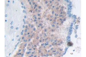 Detection of GaA in Mouse Cerebrum Tissue using Polyclonal Antibody to Glucosidase Alpha, Acid (GaA) (GAA antibody  (AA 755-953))