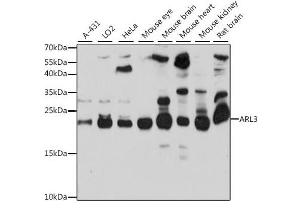 ARL3 antibody  (AA 1-182)
