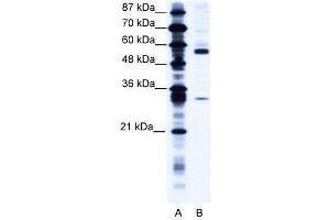 WB Suggested Anti-CORO1A  Antibody Titration: 1.