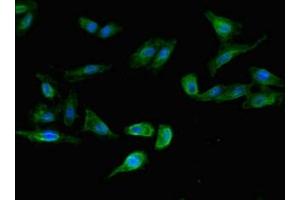 Immunofluorescent analysis of Hela cells using ABIN7158215 at dilution of 1:100 and Alexa Fluor 488-congugated AffiniPure Goat Anti-Rabbit IgG(H+L) (LSMEM1 antibody  (AA 1-131))