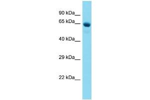 Host:  Rabbit  Target Name:  NR4A1  Sample Type:  Liver Tumor lysates  Antibody Dilution:  1. (NR4A1 antibody  (C-Term))