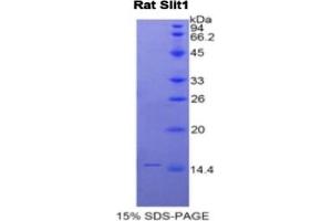 SDS-PAGE of Protein Standard from the Kit (Highly purified E. (SLIT1 ELISA Kit)