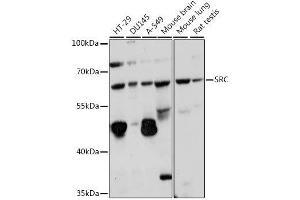 Western blot analysis of extracts of various cell lines, using SRC antibody. (Src antibody  (AA 410-536))
