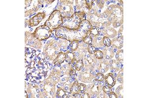 Immunohistochemistry of paraffin-embedded rat kidney using PPL antibody at dilution of 1:100 (x400 lens). (PPL antibody)