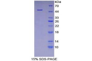 SDS-PAGE (SDS) image for Fetuin B (FETUB) (AA 149-255) protein (His tag,GST tag) (ABIN2122830)