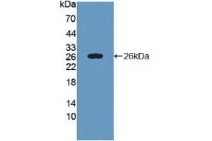 Western Blot ;Sample: Recombinant PYGL, Rat. (PYGL antibody  (AA 73-267))