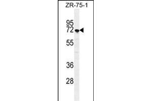 SUSD5 Antibody (C-term) (ABIN655447 and ABIN2844977) western blot analysis in ZR-75-1 cell line lysates (35 μg/lane). (SUSD5 antibody  (C-Term))
