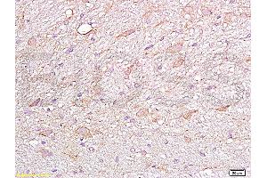 Formalin-fixed and paraffin embedded rat brain labeled Anti-FGFR4 Polyclonal Antibody, Unconjugated (ABIN671766) at 1:200, followed by conjugation to the secondary antibody and DAB staining
