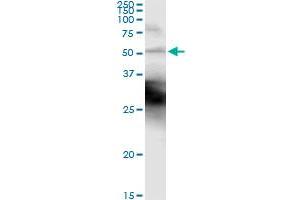 Western Blotting (WB) image for anti-Keratin 18 (KRT18) (AA 1-430) antibody (ABIN561633)