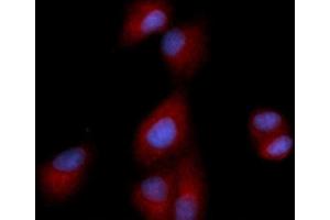 Immunofluorescence (IF) image for anti-Dipeptidyl-Peptidase 4 (DPP4) (AA 39-766) antibody (APC) (ABIN5566982) (DPP4 antibody  (AA 39-766) (APC))
