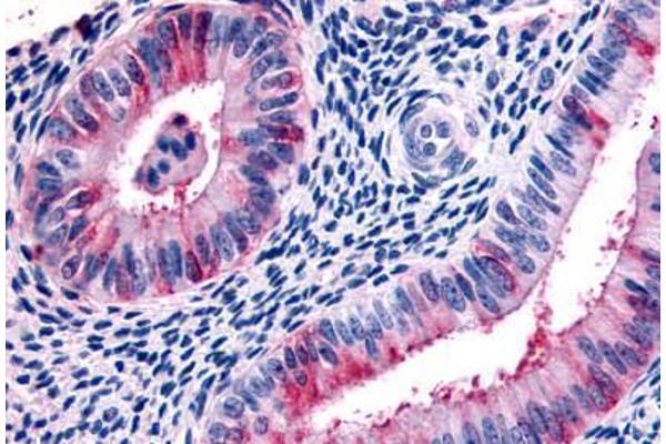 RXFP2 antibody  (Extracellular Domain)