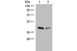 Western blot analysis of Hela and HEPG2 cell lysates using GIPC1 Polyclonal Antibody at dilution of 1:400 (GIPC1 antibody)