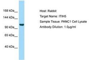 Image no. 1 for anti-Inter alpha Globulin Inhibitor H5 (ITIH5) (AA 92-141) antibody (ABIN6750011) (ITIH5 antibody  (AA 92-141))