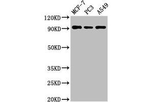 Western Blot Positive WB detected in: MCF-7 whole cell lysate, PC-3 whole cell lysate, A549 whole cell lysate All lanes: AMPD1 antibody at 3 μg/mL Secondary Goat polyclonal to rabbit IgG at 1/50000 dilution Predicted band size: 91, 90 kDa Observed band size: 91 kDa (AMPD1 antibody  (AA 97-272))