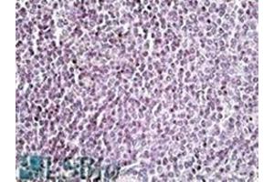 AP22454PU-N AIM2 antibody staining of paraffin embedded Human Spleen at 3. (AIM2 antibody  (C-Term))