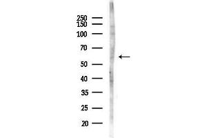 Western blot analysis of lysates from MDA-MB-231 cells(heat-shock,45 min treatment), using TBXAS1 Antibody at 1/1000 dilution.