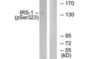 Western blot analysis of extracts from COS7 cells treated with Serum 20% 15', using IRS-1 (Phospho-Ser323) Antibody. (IRS1 antibody  (pSer323))