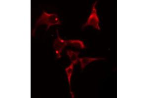 ABIN6274809 staining Hela cells by IF/ICC. (LPCAT2 antibody  (N-Term))